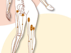 10 Siener Therapie Flyer